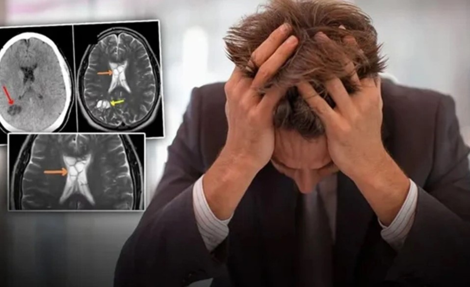 These appeared in the brain of the man who ate undercooked meat