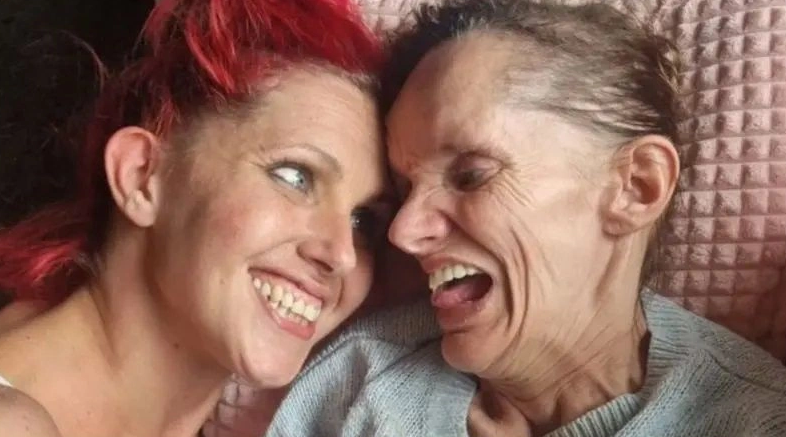 Sisters trapped in their bodies: Can’t speak, communicate only with their eyes